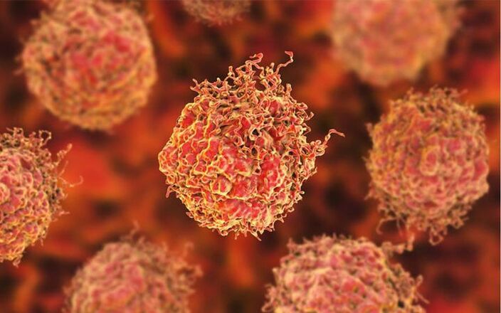 Cells -Seled prostate cancer